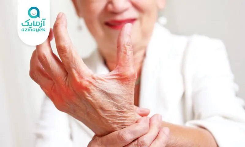 بیماری‌ روماتیسمی